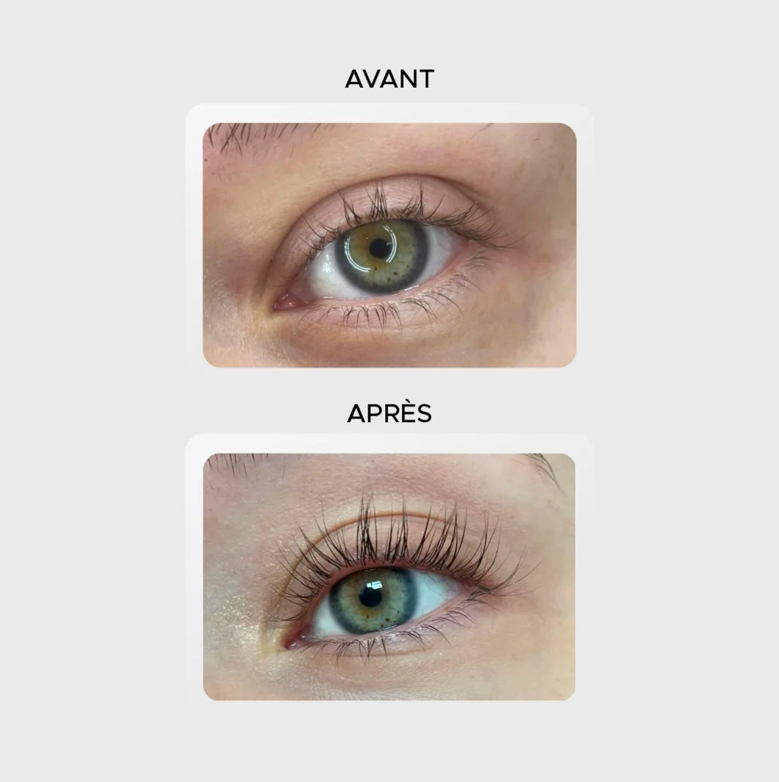 Avant / après — résultats réels