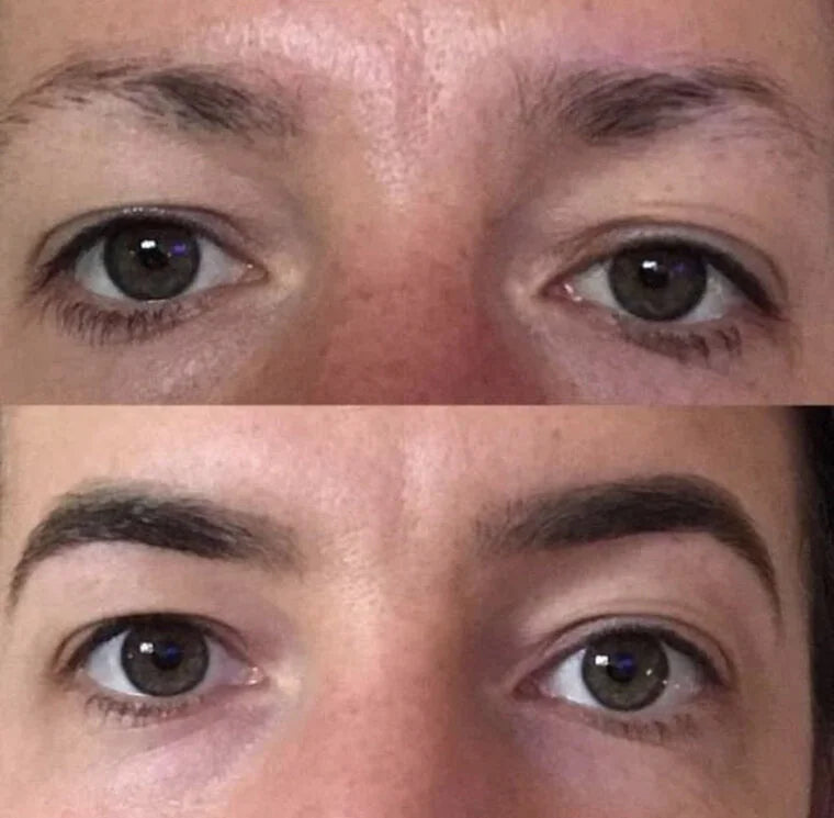Cliente Swissöra à huit semaines de cure SwissLash
